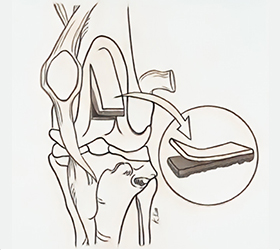 bone_img_box03.jpg