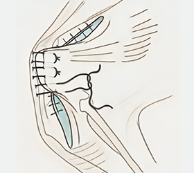 bone_img_box05.jpg