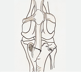 bone_img_box06.jpg