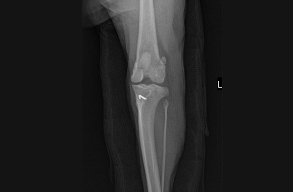 bone_xray01.jpg