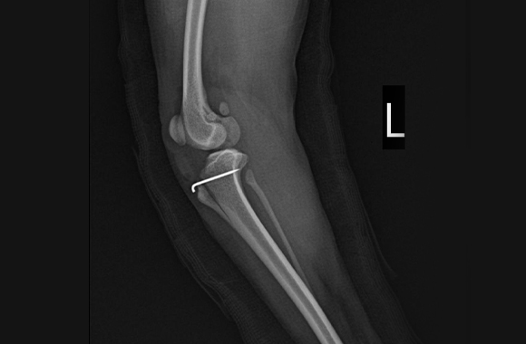 bone_xray02.jpg