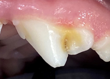 dental_di01.jpg
