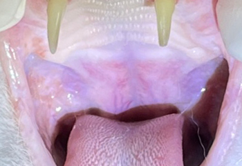 dental_treat01_01.jpg