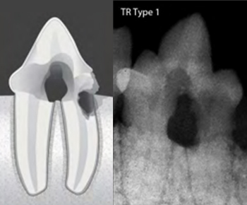 dental_type01.jpg