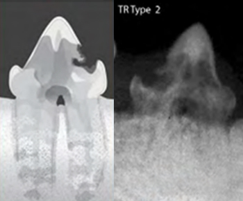 dental_type02.jpg