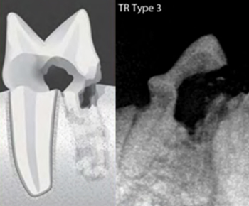 dental_type03.jpg