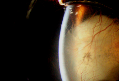 eye_di05.jpg